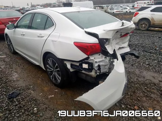 19UUB3F76JA006660 фото 4
