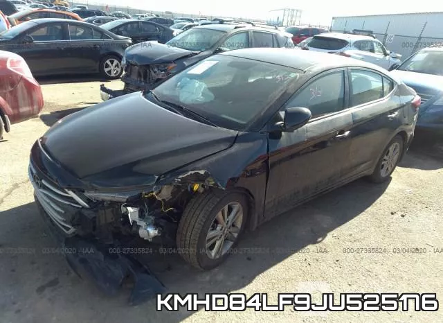 KMHD84LF9JU525176 фото 3