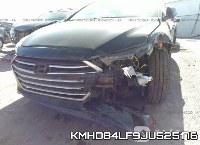 KMHD84LF9JU525176 фото 7