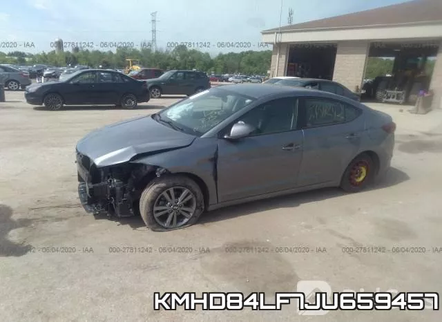 KMHD84LF7JU659457 фото 3