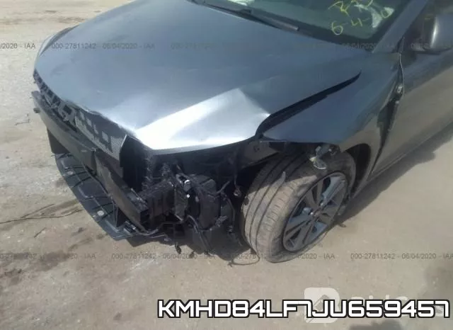 KMHD84LF7JU659457 фото 7