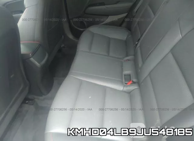 KMHD04LB9JU548185 фото 9
