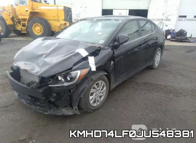 KMHD74LF0JU548381 фото 3