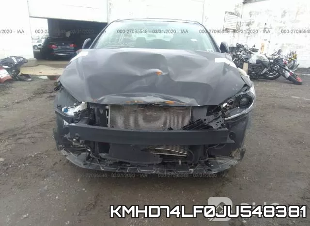 KMHD74LF0JU548381 фото 7