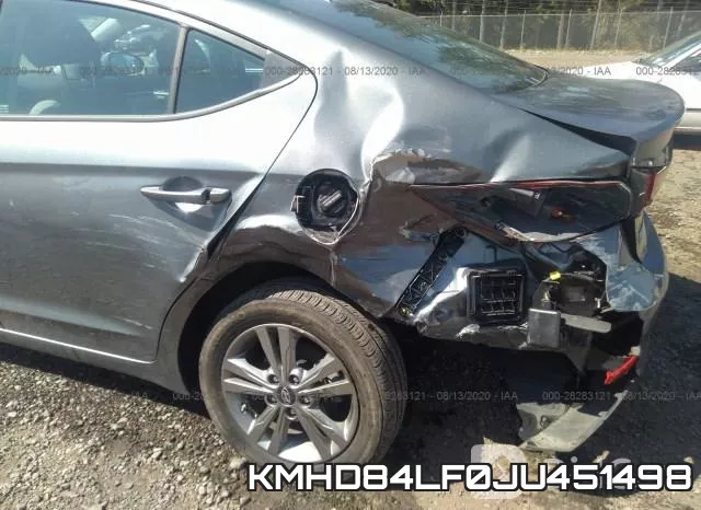 KMHD84LF0JU451498 фото 7