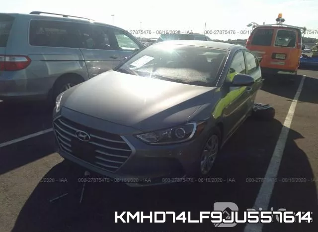 KMHD74LF9JU557614 фото 3