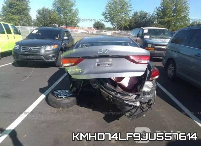 KMHD74LF9JU557614 фото 7