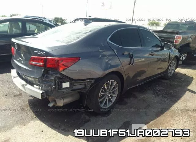 19UUB1F51JA002793 фото 5