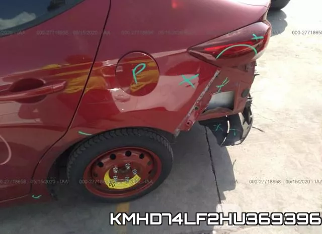 KMHD74LF2HU369396 фото 7