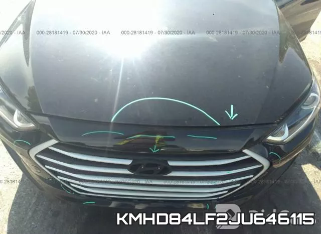 KMHD84LF2JU646115 фото 2