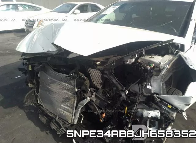 5NPE34AB8JH658352 фото 2