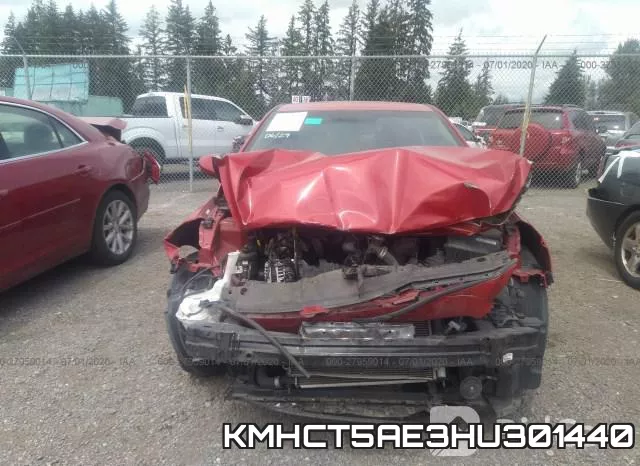 KMHCT5AE3HU301440 фото 7
