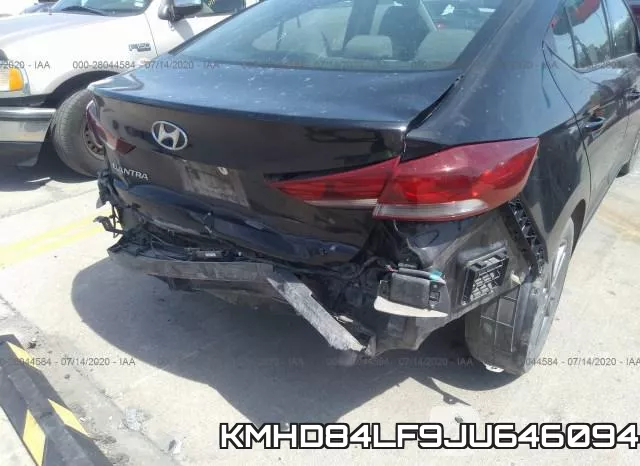 KMHD84LF9JU646094 фото 7