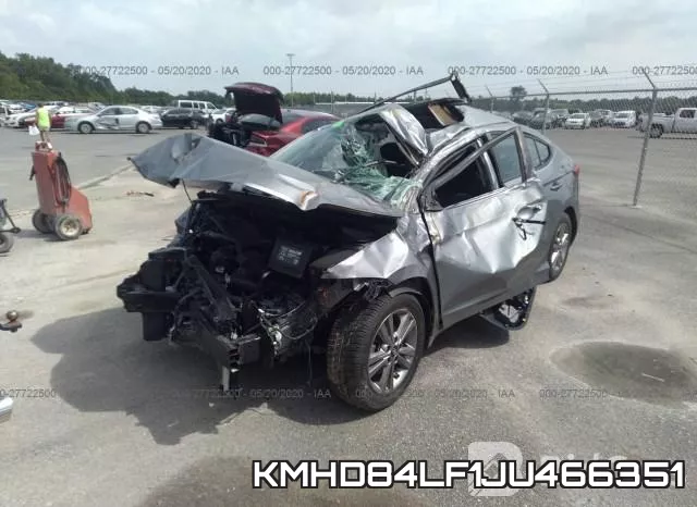 KMHD84LF1JU466351 фото 3