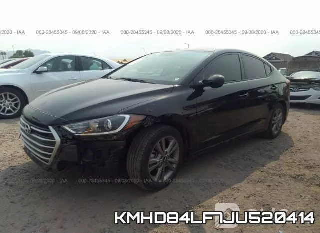 KMHD84LF7JU520414 фото 3
