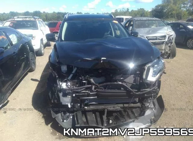 KNMAT2MV2JP559569 фото 7