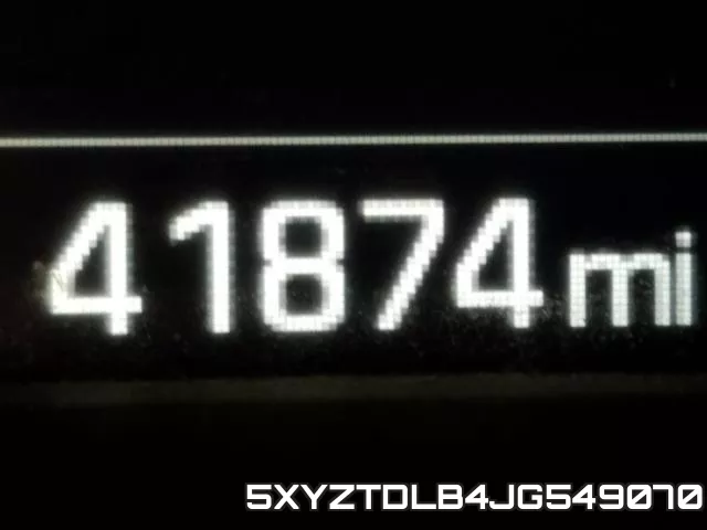 5XYZTDLB4JG549070 фото 9