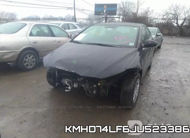 KMHD74LF6JU523386 фото 7