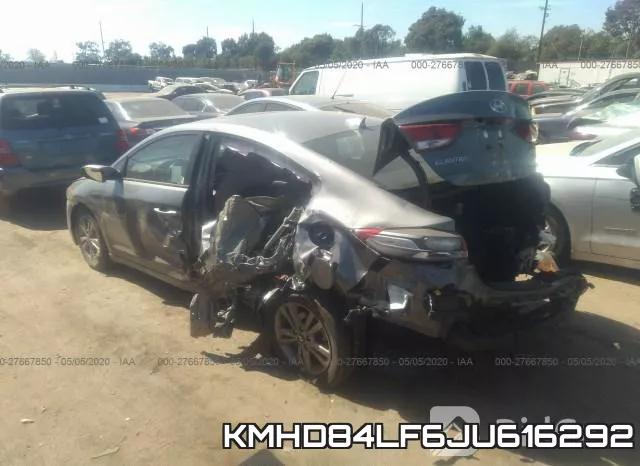 KMHD84LF6JU616292 фото 4