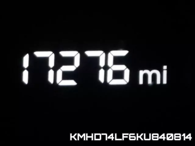 KMHD74LF6KU840814 фото 9