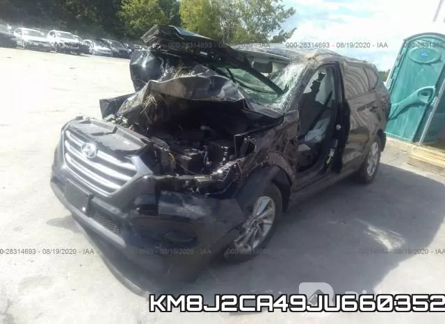 KM8J2CA49JU660352 фото 3