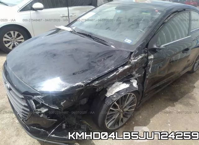KMHD04LB5JU724259 фото 7