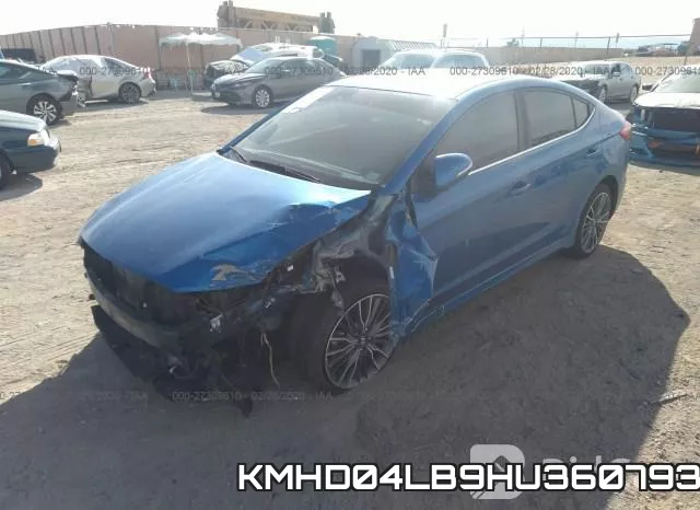 KMHD04LB9HU360793 фото 3