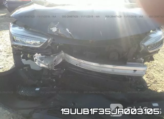 19UUB1F35JA003105 фото 7