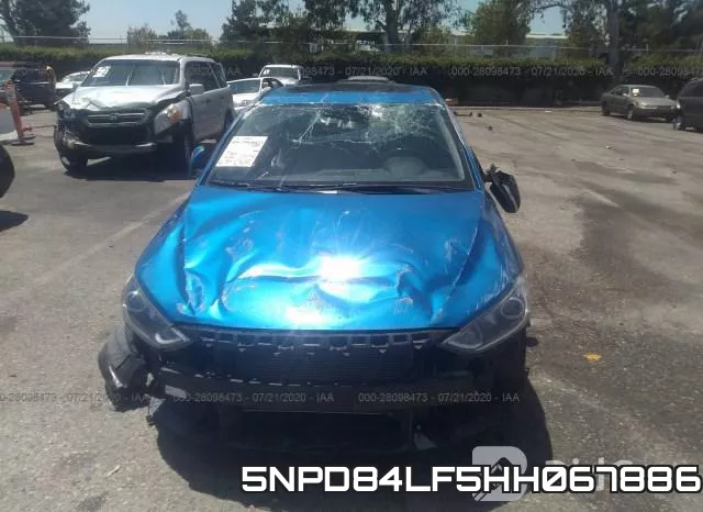 5NPD84LF5HH067886 фото 7