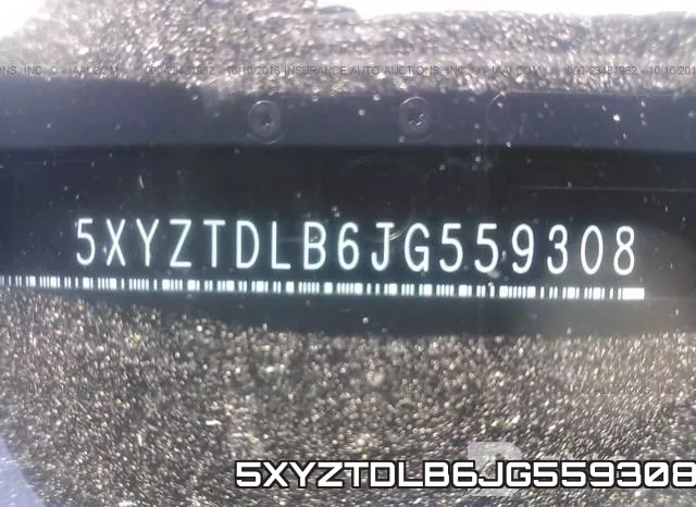 5XYZTDLB6JG559308 фото 10
