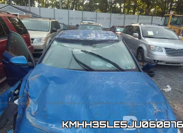 KMHH35LE5JU060876 фото 7