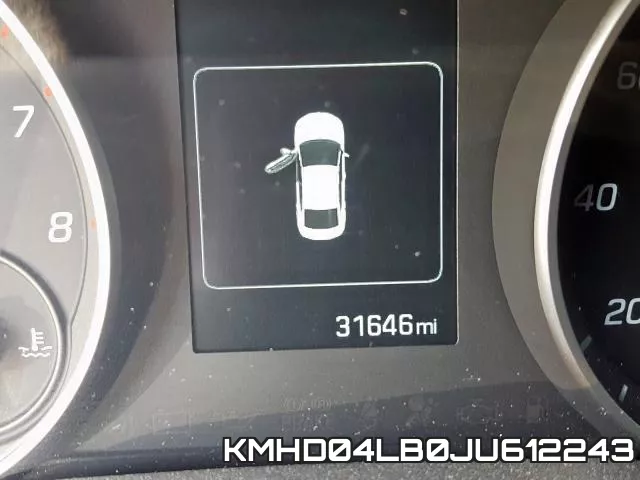 KMHD04LB0JU612243 фото 9