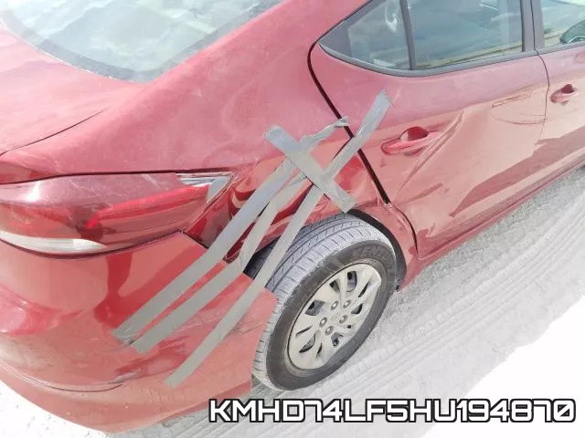 KMHD74LF5HU194870 фото 10