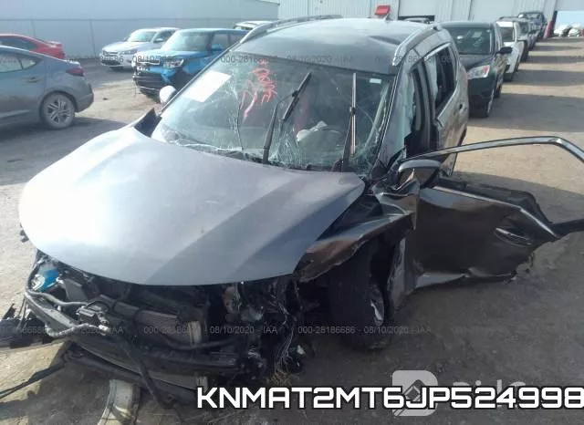 KNMAT2MT6JP524998 фото 7
