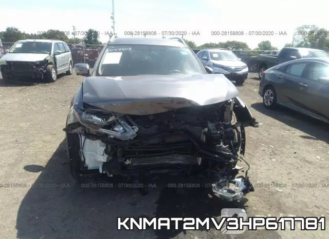 KNMAT2MV3HP617781 фото 7