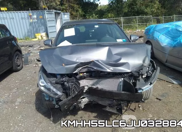 KMHH55LC6JU032884 фото 7