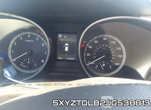 5XYZTDLB2JG538813 фото 8