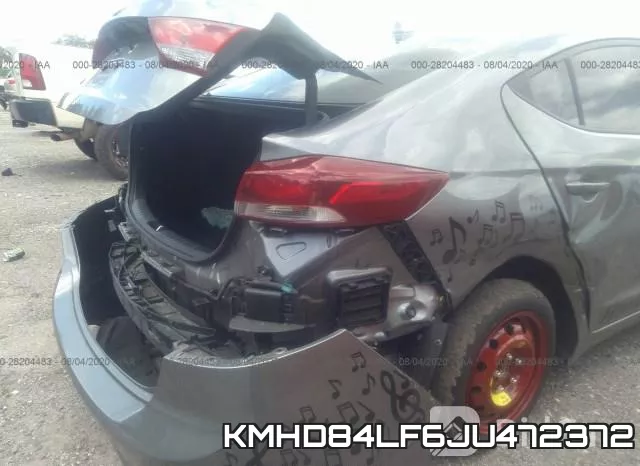 KMHD84LF6JU472372 фото 7