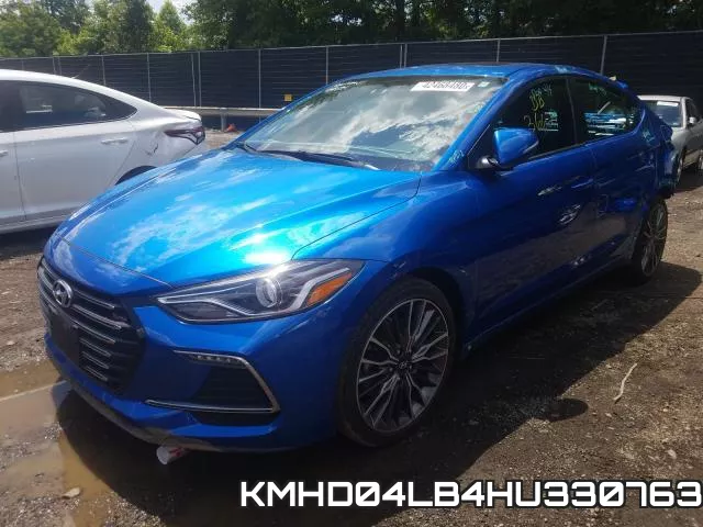 KMHD04LB4HU330763 фото 3