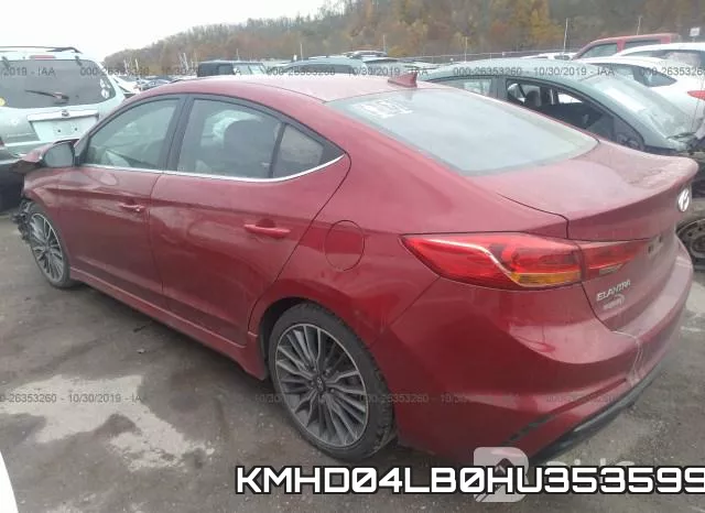KMHD04LB0HU353599 фото 4
