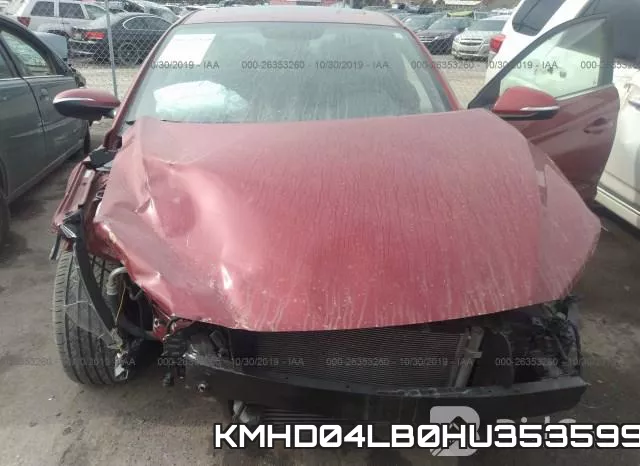 KMHD04LB0HU353599 фото 7