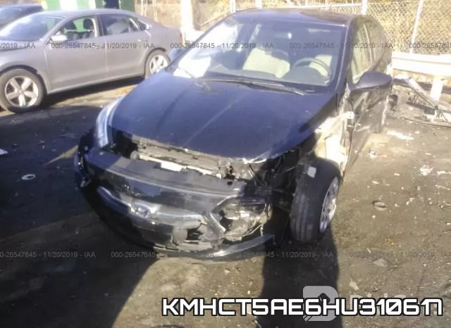 KMHCT5AE6HU310617 фото 7