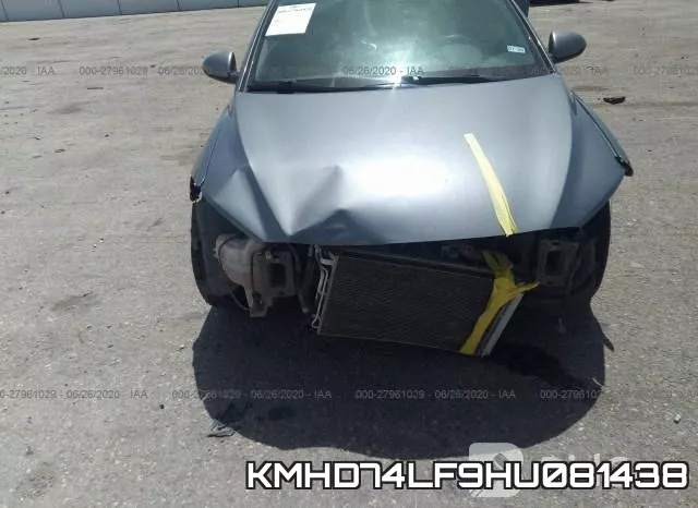 KMHD74LF9HU081438 фото 7