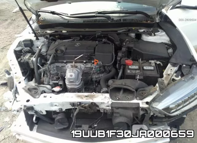 19UUB1F30JA000659 фото 2