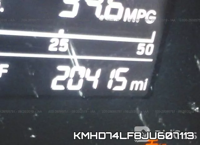 KMHD74LF8JU607113 фото 8
