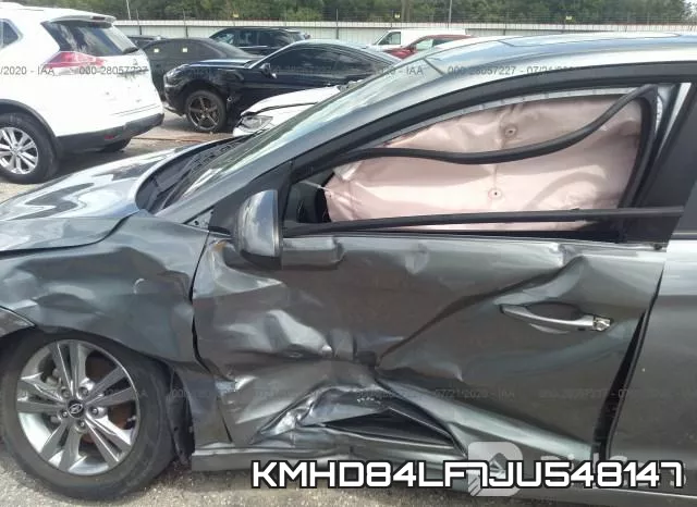 KMHD84LF7JU548147 фото 7