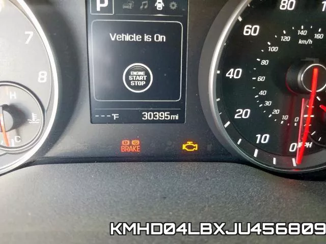 KMHD04LBXJU456809 фото 9