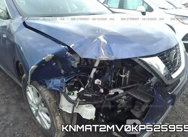 KNMAT2MV0KP525955 фото 7