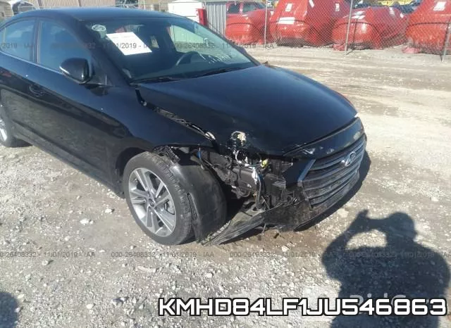 KMHD84LF1JU546863 фото 7
