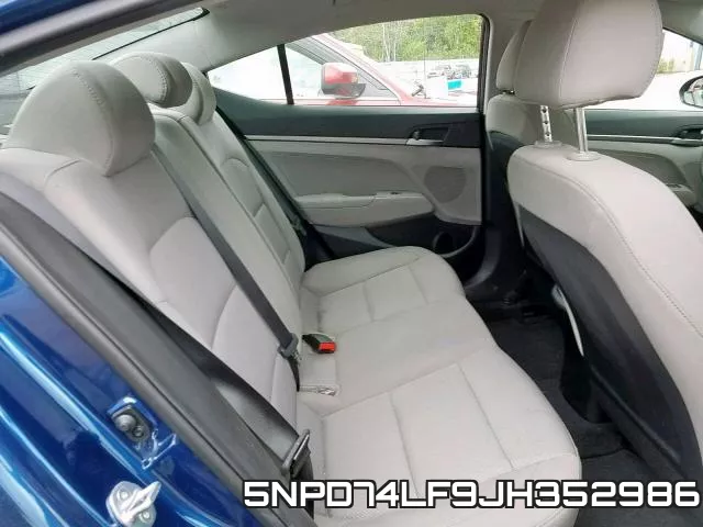 5NPD74LF9JH352986 фото 7